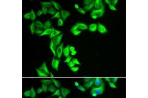 Immunofluorescence analysis of HeLa cells using STRN3 Polyclonal Antibody (STRN3 抗体)