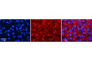 Rabbit Anti-ALDOB Antibody   Formalin Fixed Paraffin Embedded Tissue: Human Liver Tissue Observed Staining: Cytoplasm in hepatocytes Primary Antibody Concentration: N/A Other Working Concentrations: 1:600 Secondary Antibody: Donkey anti-Rabbit-Cy3 Secondary Antibody Concentration: 1:200 Magnification: 20X Exposure Time: 0. (ALDOB 抗体  (N-Term))