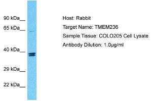 Host: Rabbit Target Name: TMEM236 Sample Tissue: Human COLO205 Whole Cell Antibody Dilution: 1ug/ml (TMEM236 抗体  (Middle Region))