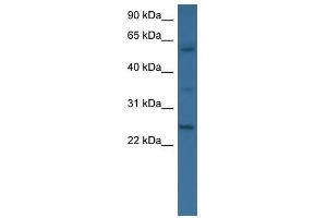 BMP6 antibody used at 0. (BMP6 抗体  (N-Term))