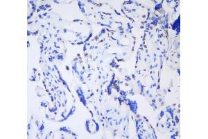 IHC analysis of HP1 gamma using anti-HP1 gamma antibody (ABIN5693033). (CBX3 抗体  (AA 2-183))