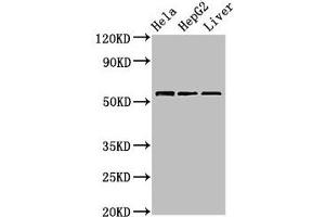 Western Blot Positive WB detected in: Hela whole cell lysate, HepG2 whole cell lysate, Mouse liver tissue All lanes: TOM1 antibody at 2. (TOM1 抗体  (AA 306-487))