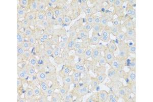 Immunohistochemistry of paraffin-embedded Rat liver using ASGR1 Polyclonal Antibody at dilution of 1:100 (40x lens). (Asialoglycoprotein Receptor 1 抗体)