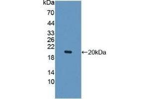 Detection of Recombinant IL10Rb, Human using Polyclonal Antibody to Interleukin 10 Receptor Beta (IL10Rb) (IL10RB 抗体  (AA 87-243))