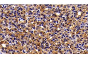 Detection of CK18 in Rat Stomach Tissue using Polyclonal Antibody to Cytokeratin 18 (CK18) (Cytokeratin 18 抗体  (AA 72-380))