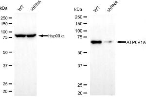 Western blotting analysis using ATP6V1A antibody (ABIN7797699).