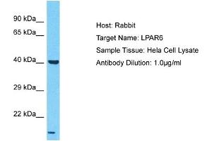 Host: Rabbit Target Name: LPAR6 Sample Type: Hela Whole Cell lysates Antibody Dilution: 1. (LPAR6 抗体  (N-Term))