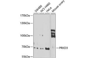 Western blot analysis of extracts of various cell lines, using PRKD3 antibody (ABIN6128465, ABIN6146216, ABIN6146217 and ABIN6222885) at 1:1000 dilution. (PRKD3 抗体  (AA 1-100))