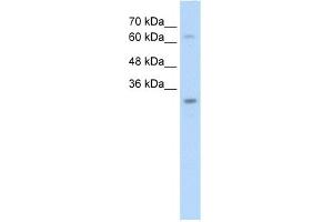 WB Suggested Anti-NSMCE1 Antibody Titration:  2. (NSMCE1 抗体  (N-Term))