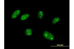 Immunofluorescence of purified MaxPab antibody to KATNAL2 on HeLa cell. (KATNAL2 抗体  (AA 1-466))