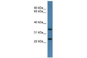 WB Suggested Anti-Clns1a Antibody Titration: 0. (CLNS1A 抗体  (C-Term))
