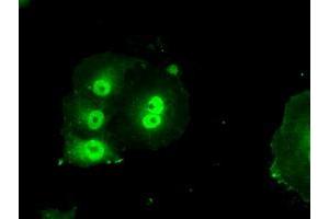 Anti-BIRC7 mouse monoclonal antibody (ABIN2452813) immunofluorescent staining of COS7 cells transiently transfected by pCMV6-ENTRY BIRC7 (RC204906). (BIRC7 抗体)