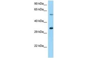 Image no. 1 for anti-Ubiquitin Specific Peptidase 27, X-Linked (USP27X) (AA 91-140) antibody (ABIN6748295) (USP27X 抗体  (AA 91-140))