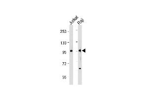 All lanes : Anti-P4K1 Antibody at 1:2000 dilution Lane 1: Jurkat whole cell lysate Lane 2: Raji whole cell lysate Lysates/proteins at 20 μg per lane. (MAP4K1 抗体  (Tyr381))