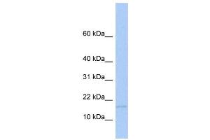 WB Suggested Anti-MED21 Antibody Titration:  0. (MED21 抗体  (Middle Region))