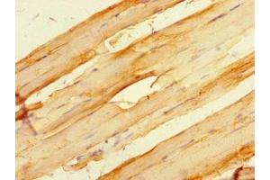 Immunohistochemistry (IHC) image for anti-Heat Shock 27kDa Protein Family, Member 7 (Cardiovascular) (HSPB7) (AA 1-170) antibody (ABIN7154917)