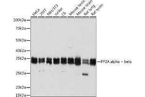 Western blot analysis of extracts of various cell lines, using PP2A alpha + beta Rabbit mAb (ABIN7269686) at 1:1000 dilution. (PPP2CB 抗体)
