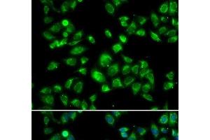 Immunofluorescence analysis of U2OS cells using MBTPS1 Polyclonal Antibody (MBTPS1 抗体)