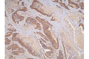 IHC analysis of IL31 using anti-IL31 antibody (ABIN6719334).