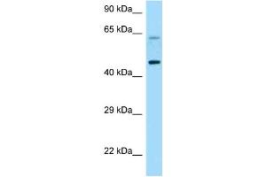 WB Suggested Anti-CRHR1 Antibody Titration: 1.