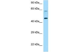 WB Suggested Anti-CRHR1 Antibody Titration: 1. (CRHR1 抗体  (C-Term))