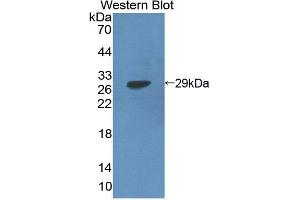 Western blot analysis of the recombinant protein. (NR5A2 + LRH1 抗体  (AA 300-541))