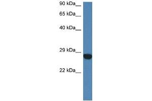 WB Suggested Anti-Ccdc90b Antibody   Titration: 1. (CCDC90B 抗体  (N-Term))