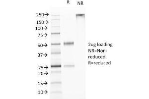 SDS-PAGE Analysis Purified TNFS15 / VEGI Monoclonal Antibody (VEGI /1283). (TNFSF15 抗体)