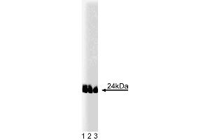 Western blot analysis of caveolin-1 (pY14) on lysates from A431 cells (Human epithelial carcinoma, ATCC CRL-1555) treated with 100 ng/mL EGF. (Caveolin 抗体  (pTyr14))