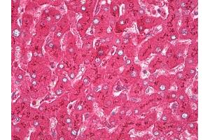 Anti-Haptoglobin antibody IHC of human liver. (Haptoglobin 抗体  (AA 19-406))