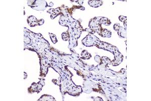 IHC analysis of AHR using anti-AHR antibody (ABIN6719265).
