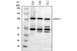 Western blot analysis of HERC5 using anti-HERC5 antibody (ABIN6719405).