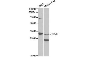 Western blot analysis of extracts of various cell lines, using TPMT antibody. (TPMT 抗体)