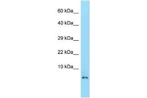 WB Suggested Anti-Hmgn2 Antibody   Titration: 1. (HMGN2 抗体  (Middle Region))