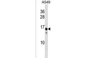 KRAB-related domain-containing protein Antibody (N-term) (ABIN1538891 and ABIN2838089) western blot analysis in A549 cell line lysates (35 μg/lane). (SSX11 (AA 1-30), (N-Term) 抗体)
