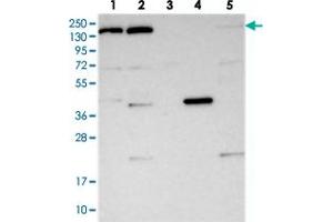 Western blot analysis of Lane 1: RT-4, Lane 2: U-251 MG, Lane 3: Human Plasma, Lane 4: Liver, Lane 5: Tonsil with POLR2B polyclonal antibody  at 1:250-1:500 dilution. (POLR2B 抗体)