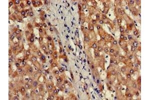 Immunohistochemistry of paraffin-embedded human liver tissue using ABIN7164093 at dilution of 1:100 (PRDM2 抗体  (AA 733-961))