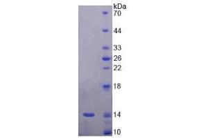 SDS-PAGE analysis of Rat Corin Protein. (Corin 蛋白)