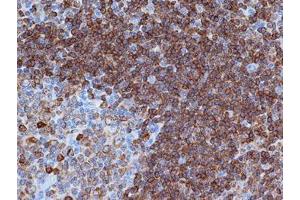 Immunohistochemistry (IHC) image for anti-B-cell antigen receptor complex-associated protein alpha chain (CD79A) (AA 202-216) antibody (ABIN181098) (CD79a 抗体  (AA 202-216))