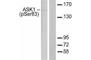 Western blot (WB) analysis of p-ASK1 antibody in paraffin-embedded human breast carcinoma tissue. (ASK1 抗体  (pSer966))
