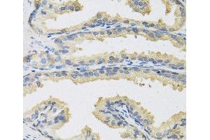 Immunohistochemistry of paraffin-embedded Human prostate using CST3 Polyclonal Antibody at dilution of 1:100 (40x lens). (CST3 抗体)