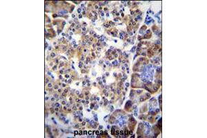 SMYD4 Antibody immunohistochemistry analysis in formalin fixed and paraffin embedded human pancreas tissue followed by peroxidase conjugation of the secondary antibody and DAB staining. (SMYD4 抗体  (C-Term))