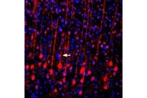 Immunohistochemistry (IHC) image for anti-Solute Carrier Family 17 (Vesicular Glutamate Transporter), Member 6 (SLC17A6) (AA 45-56), (Cytosolic) antibody (ABIN7043681)