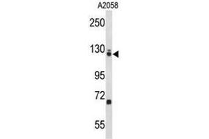 Western blot analysis of EFTUD2 Antibody (Center) in A2058 cell line lysates (35µg/lane).