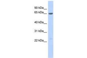 Image no. 1 for anti-Synovial Sarcoma, X Breakpoint 7 (SSX7) (AA 107-156) antibody (ABIN6743585) (SSX7 抗体  (AA 107-156))