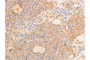 ABIN6267232 at 1/100 staining rat ovarian tissue sections by IHC-P. (Tumor Protein p73 抗体  (pTyr99))