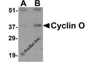 Western Blotting (WB) image for anti-Cyclin O (CCNO) (N-Term) antibody (ABIN1031340)