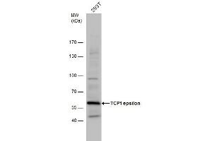 WB Image TCP1 epsilon antibody detects TCP1 protein by western blot analysis. (CCT5 抗体)