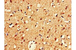 IHC image of ABIN7148735 diluted at 1:600 and staining in paraffin-embedded human brain tissue performed on a Leica BondTM system. (CELF2 抗体  (AA 291-381))