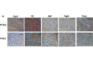 Immunohistochemistry (Paraffin-embedded Sections) (IHC (p)) image for anti-Proliferating Cell Nuclear Antigen (PCNA) antibody (ABIN2854788)